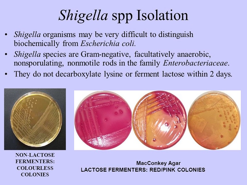 Nuôi cấy định danh vi khuẩn Shigella
